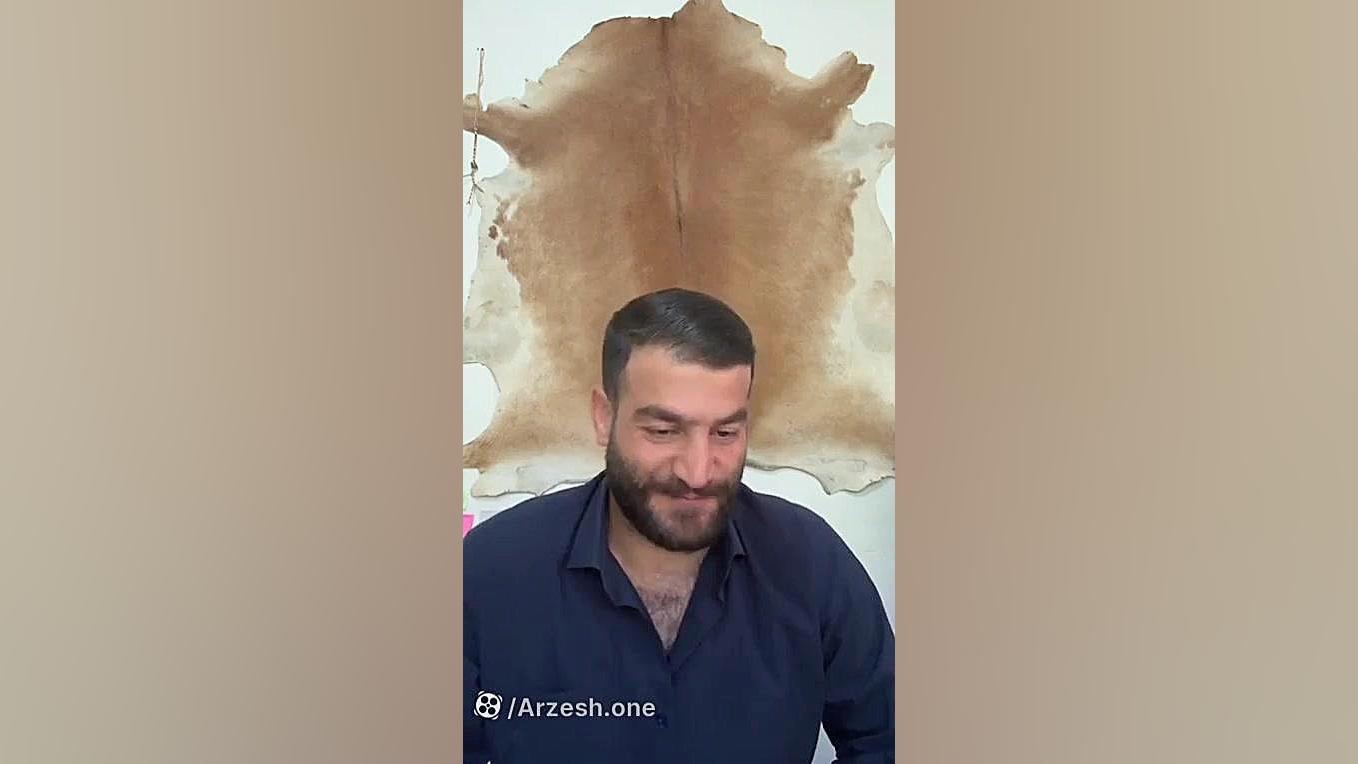 تروما و تاصیرات عمیق آن در زندگی های شما دندانپزشکی کودکان