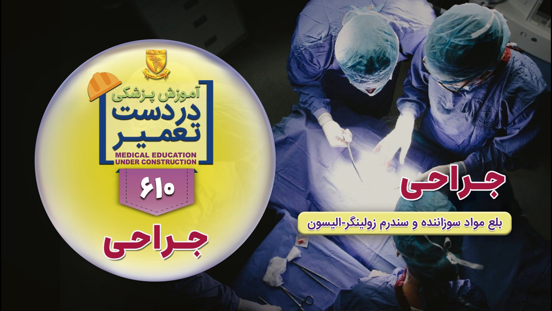 جراحی (بلع مواد سوزاننده و سندرم زولینگر - الیسون) قلی قندق