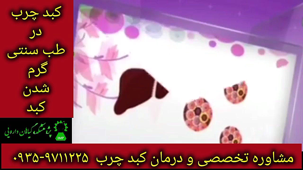 کبد گرم درمان و پاکسازی کبد چرب ۰۹۳۵۹۷۱۱۲۲۵ کامپوزیت ونیر