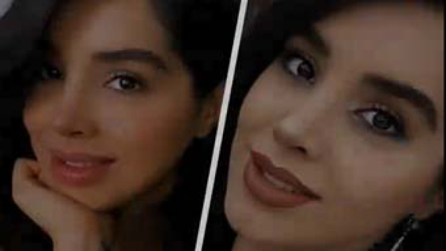 جراحی زیبایی بینی  | دکتر نظری