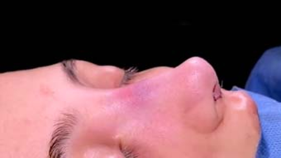 جراحی زیبایی بینی | دکتر نظری