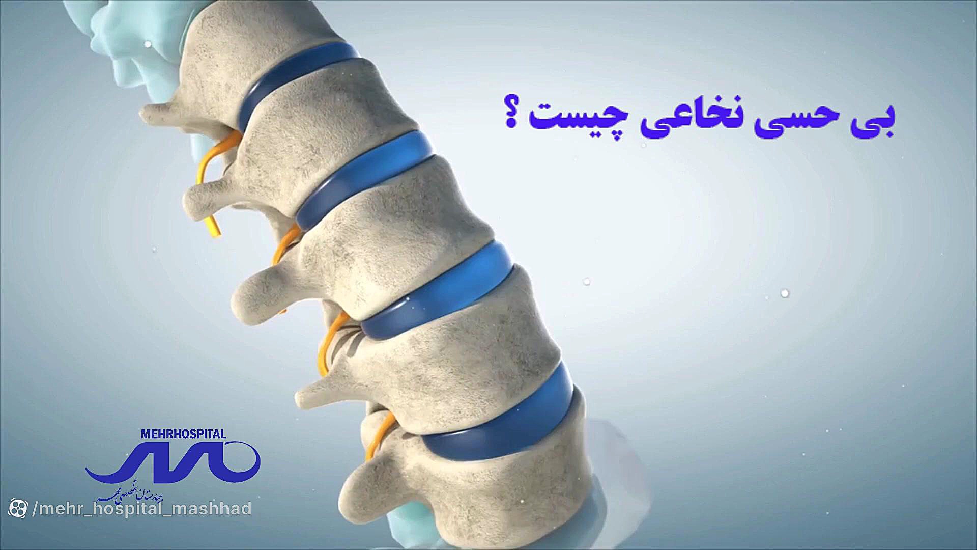 بی حسی نخاعی جراحی پف زیر چشم