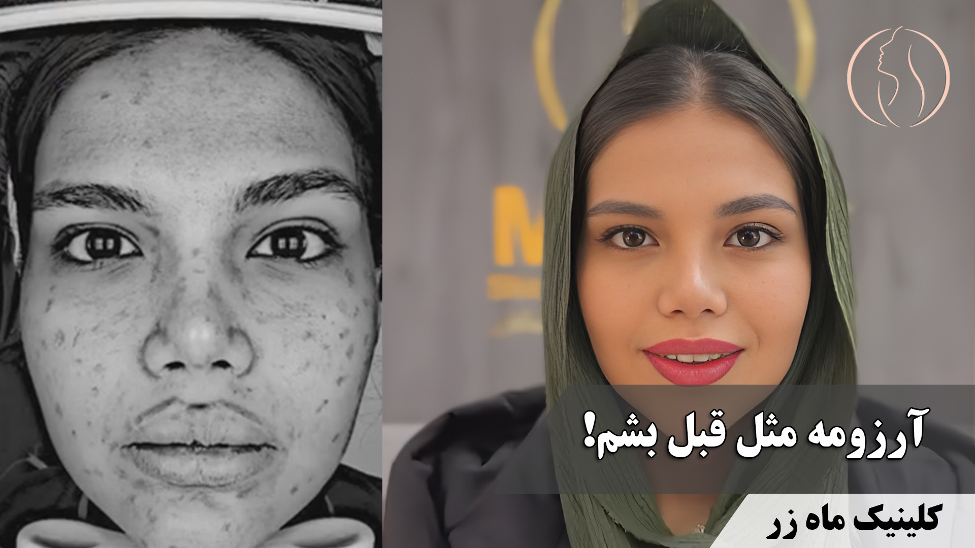 وقتی با کرم‌پودر خداحافظی کردم! ( کلینیک زیبایی ماه زر ) آزمایش شمارش رتیکولوسیت