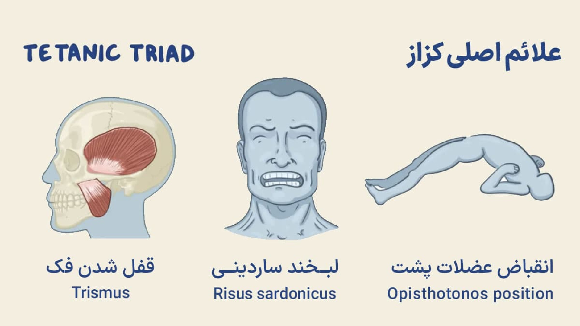 علائم و درمان بیماری کزاز ارتودنسی