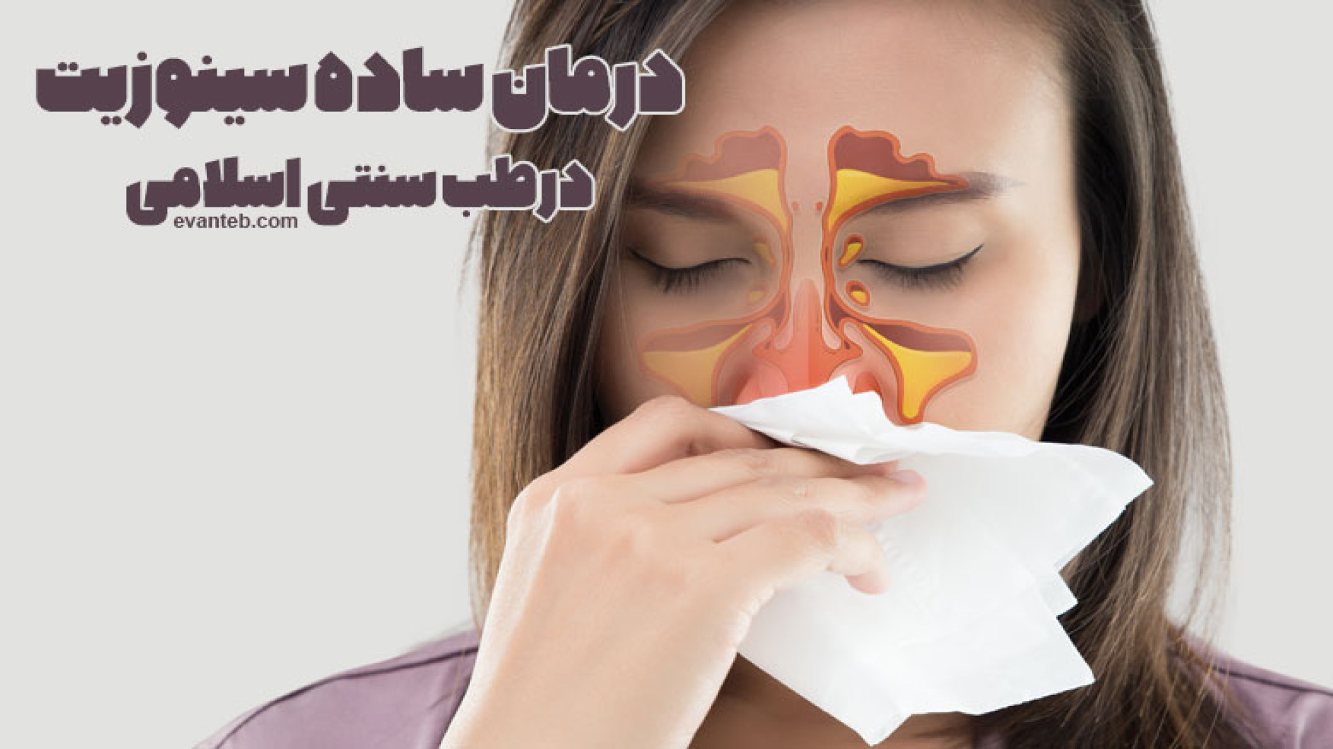 توصیه و درمان ساده سینوزیت در طب سنتی اسلامی عصب‌کشی