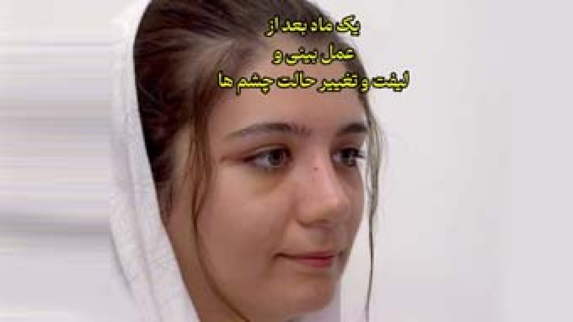 جراحی زیبایی بینی و لیفت چشم ها | دکتر امین قانعی دکتر امین قانعی - جراح پلاستیک در اصفهان