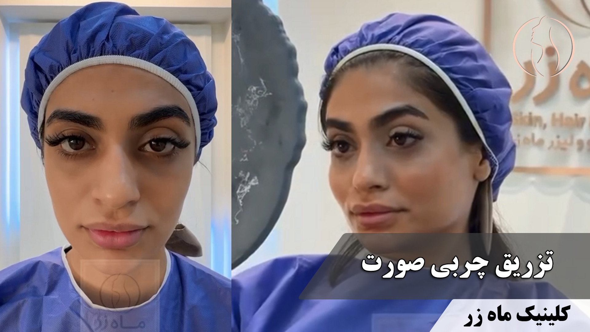 خوشبختی از چهرت شروع میشه! باور کن! ( کلینیک زیبایی ماه زر ) اوتیلومیومبر