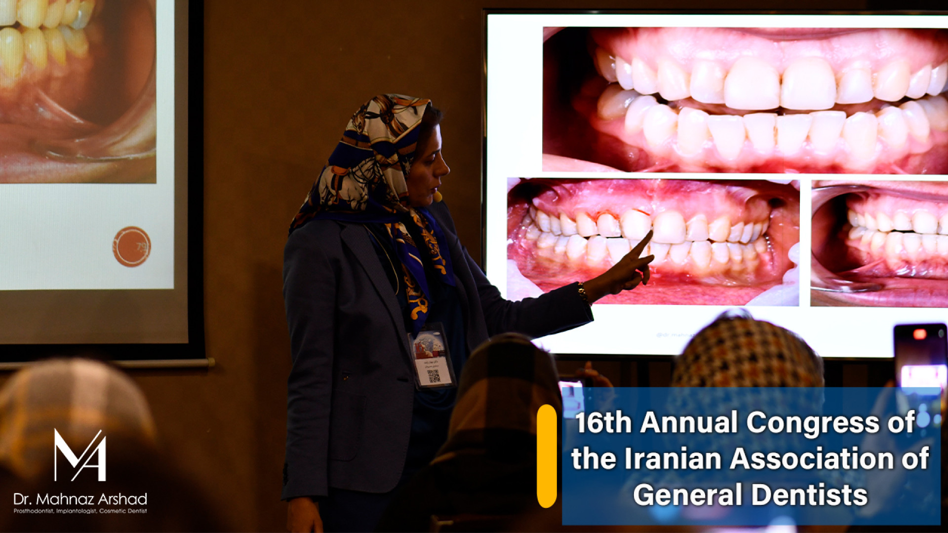 *شانزدهمین کنگره علمی سالیانه انجمن دندانپزشکان عمومی ایران دکتر مهناز ارشد