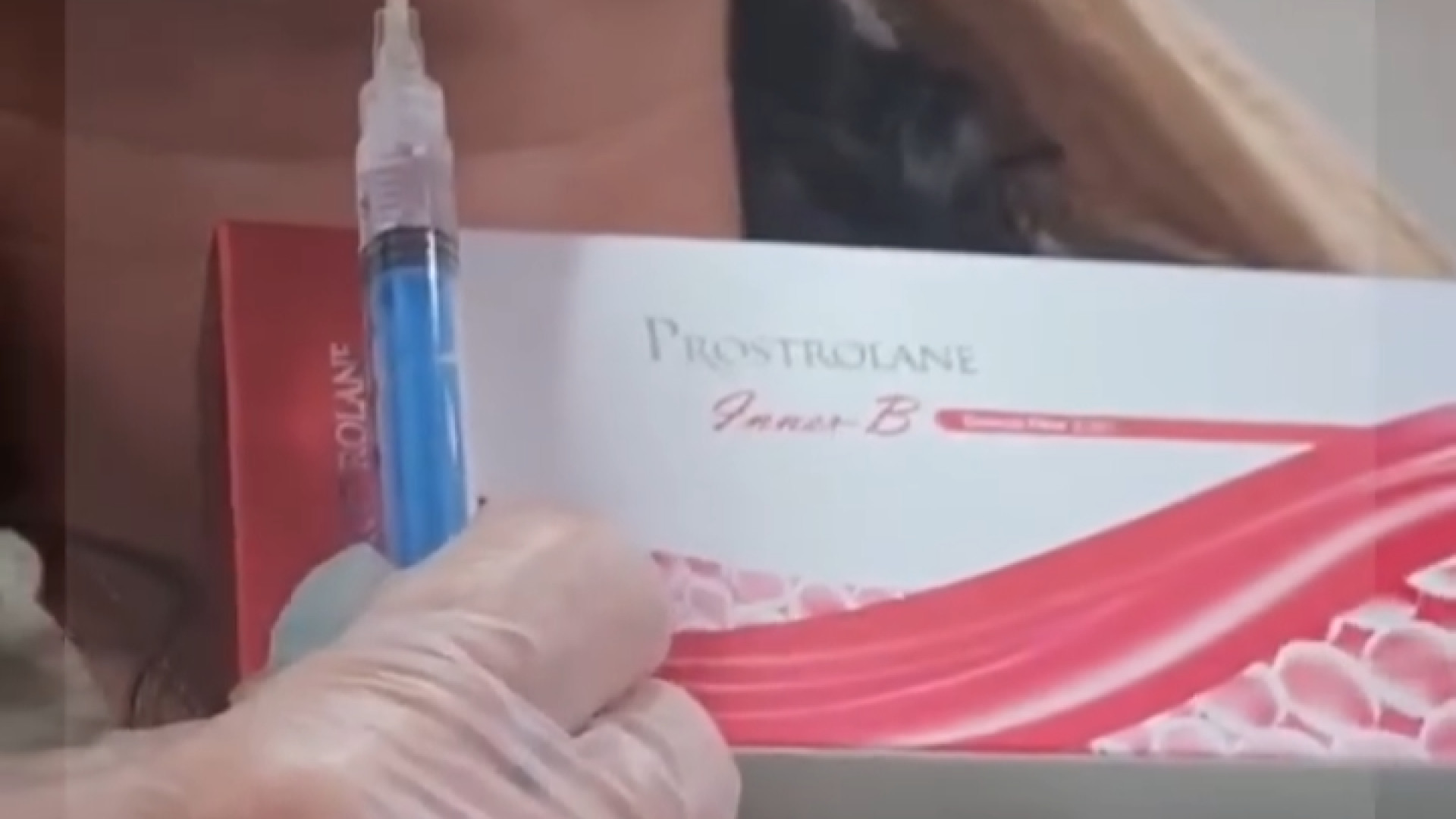 مزوتراپی | دکتر مریم بیکی دکتر مریم بیکی - پوست و مو و زیبایی اراک