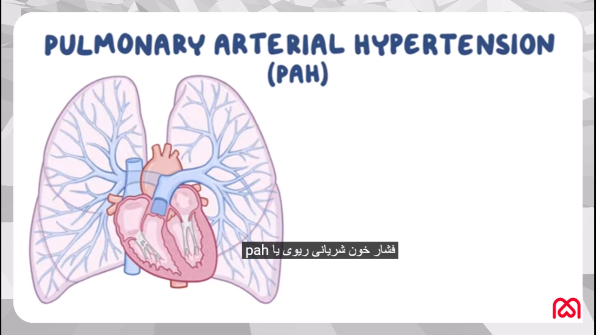 همه چیز درباره پرفشاری ریه چالش خرگوشی