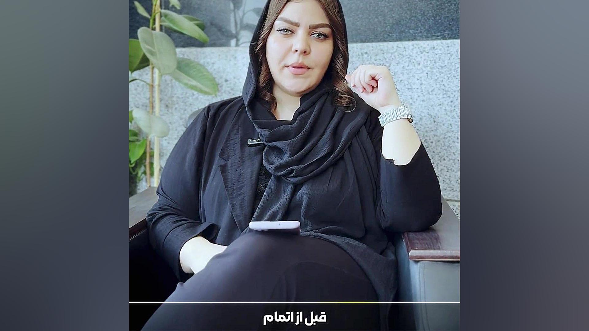 آرکا ازن |طراح قطعات ، تولید کننده| ازن ژنراتور | اکسیژن ساز تزریق چربی