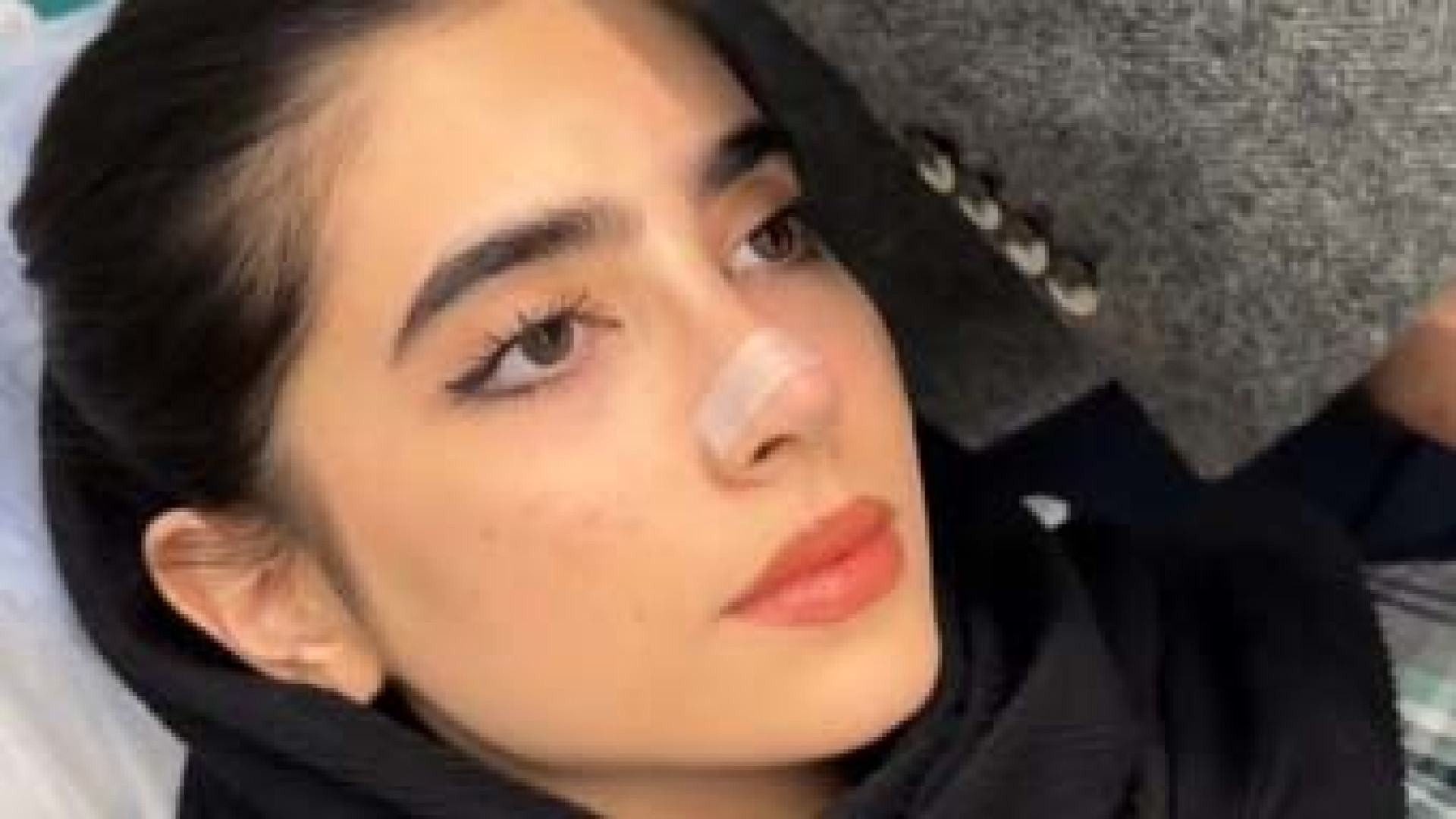 آموزش چسب زدن بینی | دکتر محمد مجیدی دکتر محمد مجیدی - جراحی بینی به سبک طبیعی شیک