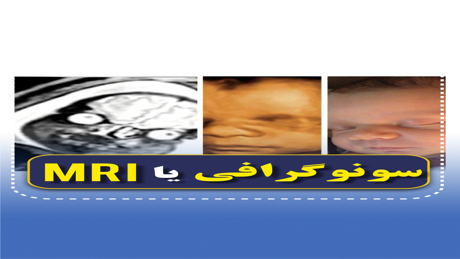 چرا بجای سونوگرافی MRI نکنیم؟ مرکز تصویربرداری دکتر مریم ابراهیمی، مبنا-تهران