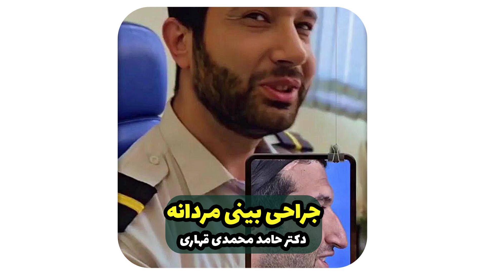 جراحی بینی مردانه دکتر حامد محمدی قهاری