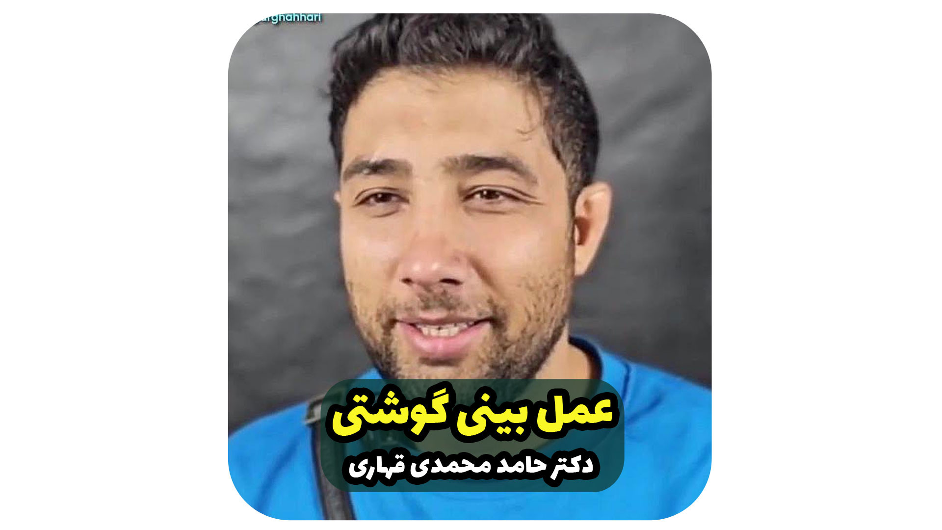 عمل بینی گوشتی دکتر حامد محمدی قهاری
