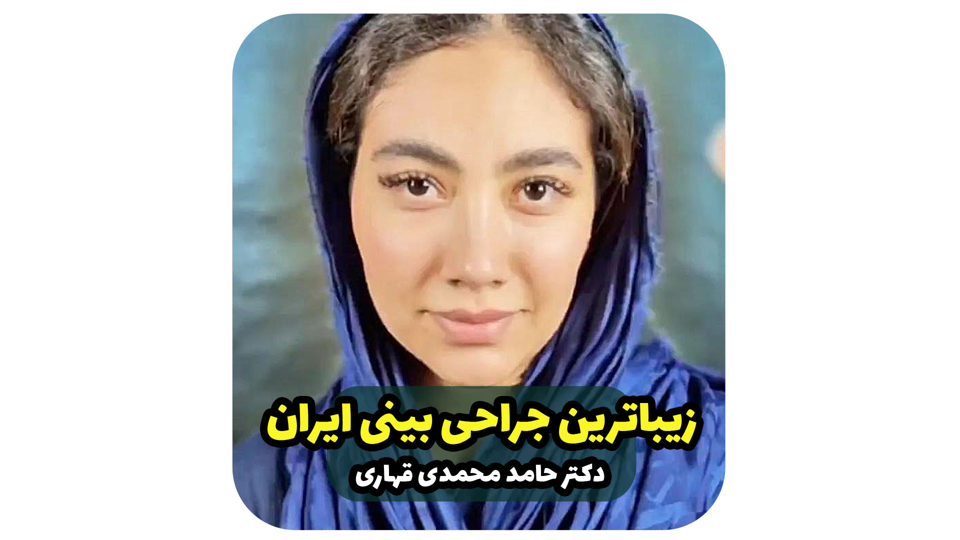 زیباترین جراحی بینی ایران دکتر حامد محمدی قهاری