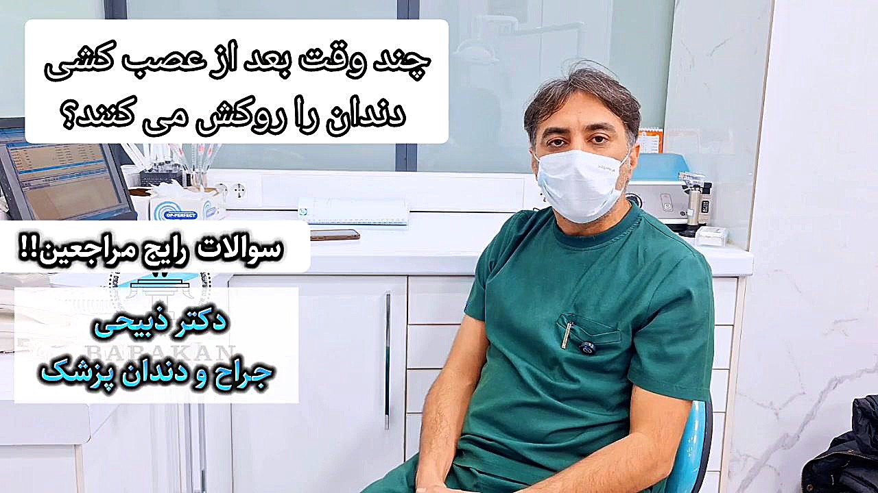 چند وقت بعد از عصب کشی دندان را روکش می کنند؟ پاسخ دکتر ذبیحی کلینیک دندانپزشکی بابکان
