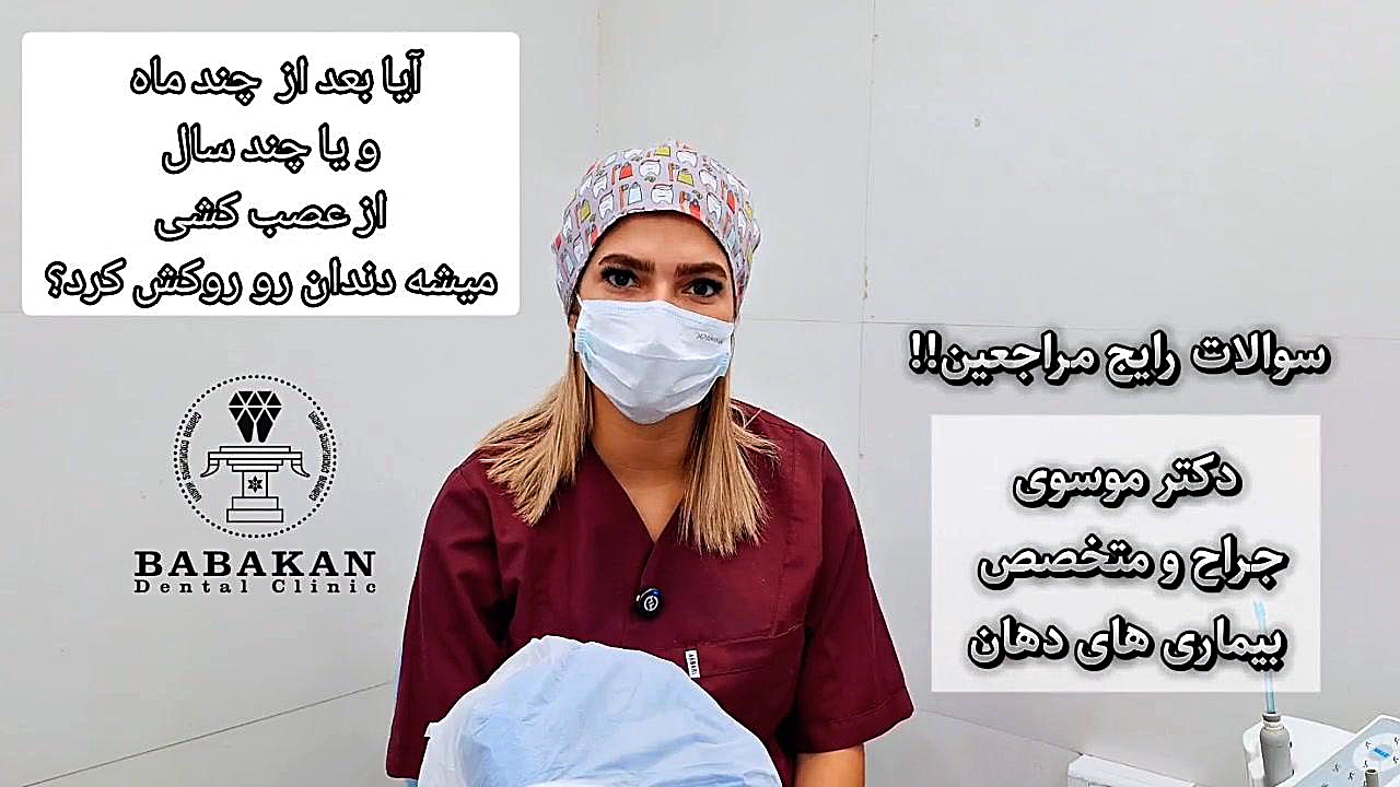 آیا چند ماه بعد از عصب کشی میتوان دندان را روکش کرد؟ پاسخ دکتر موسوی کلینیک دندانپزشکی بابکان