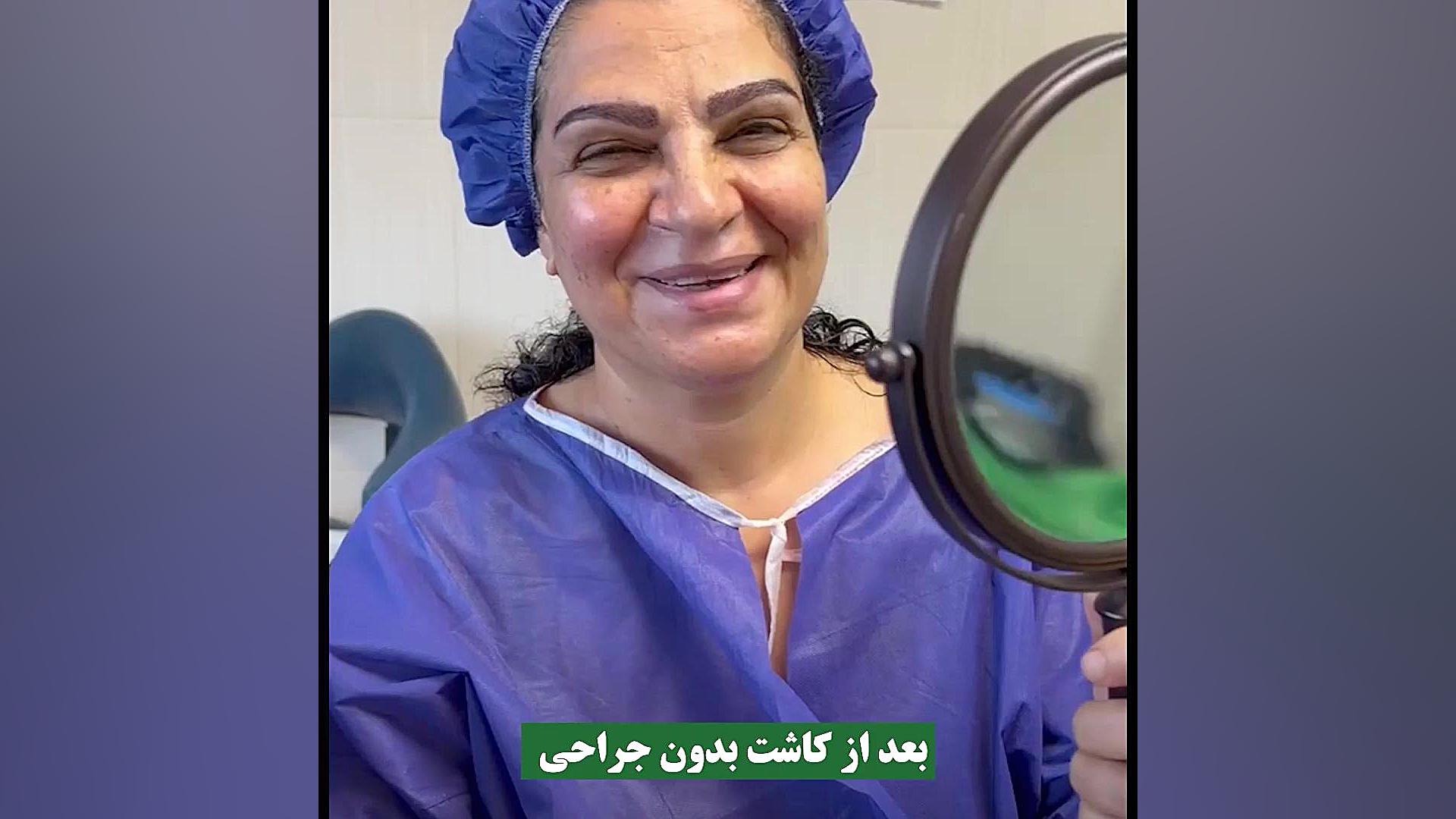 رضایت مراجعه کننده عزیز کاشت ابرو در کلینیک کاشت مو و ابرو ایران فیت تست لوسمی باقی‌مانده