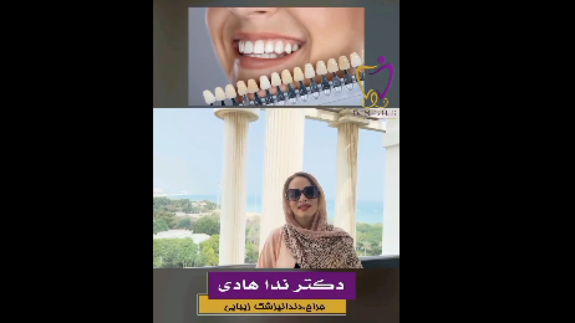 انتخاب رنگ کامپوزیت دندان دکتر ندا هادی-دندانپزشک زیبایی