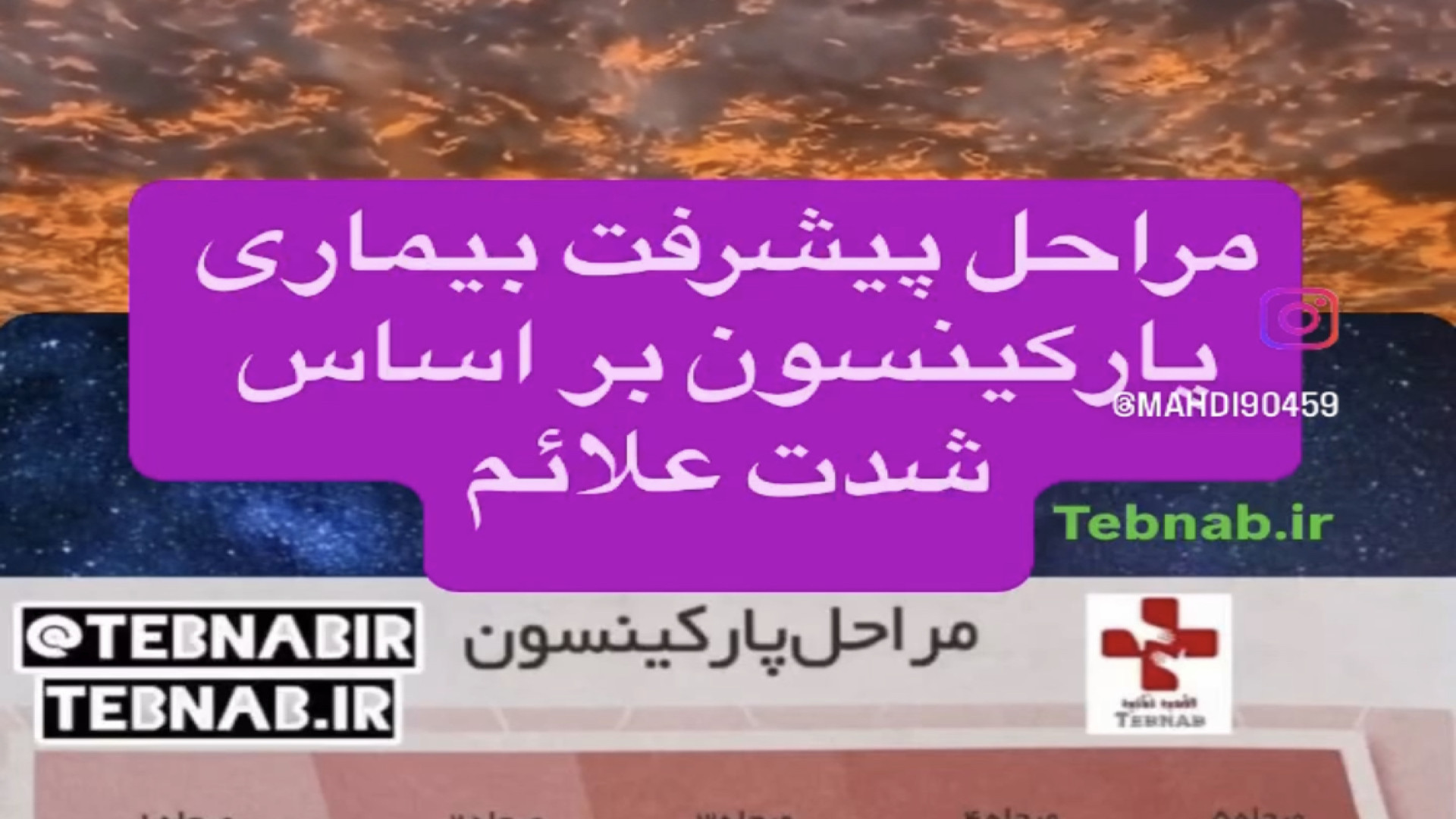 مقیاس پیشرفت بیماری پارکینسون لیزر موهای زائد