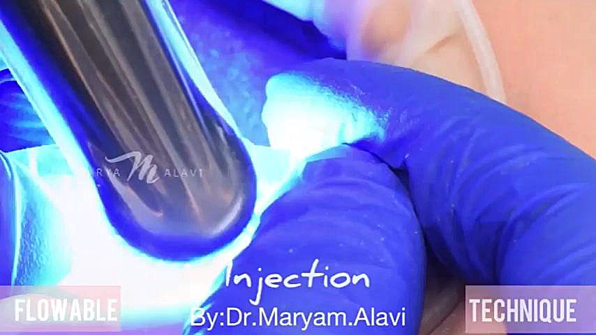 اینجکشن تکنیک دکتر مریم علوی
