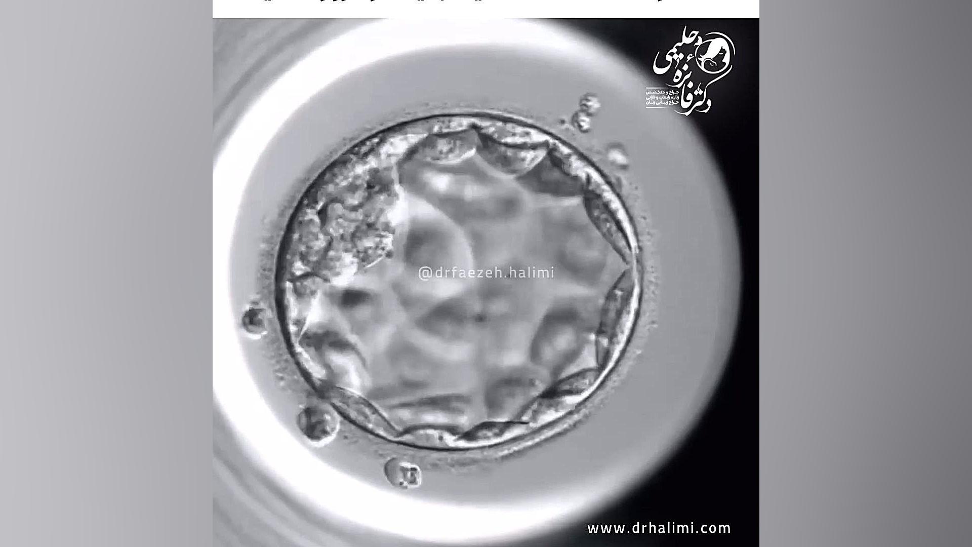 تشکیل جنین در 5 روز دکتر فائزه حلیمی