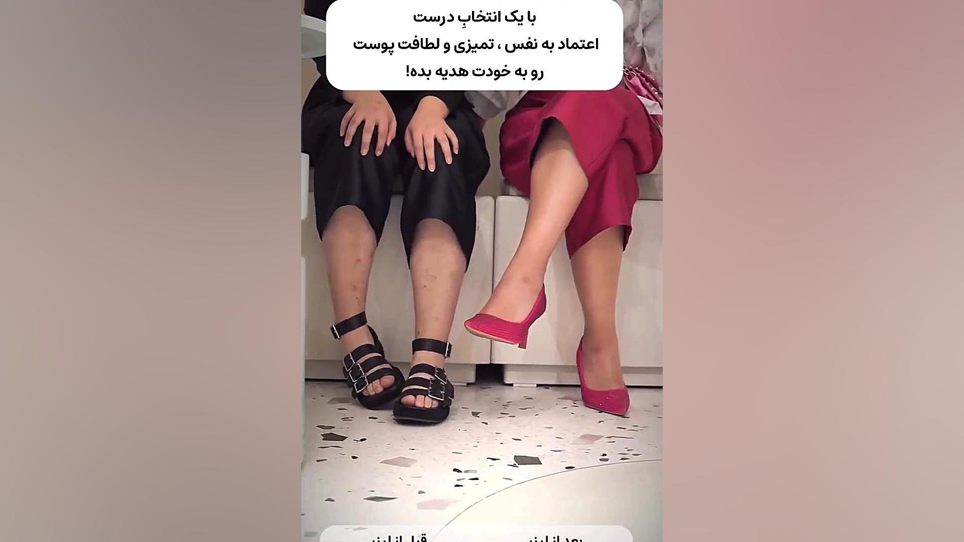 کلینیک لیزر تهرانسر - سایت بهترین در تهران ایمپلنت مغز-ماشین