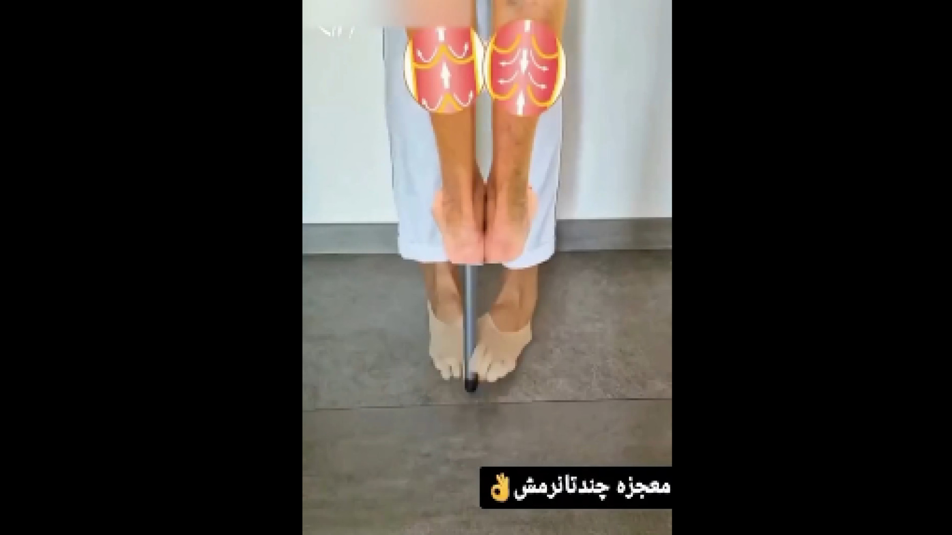 درمان مشکلات پا با نرمش دکتر آرش اریس