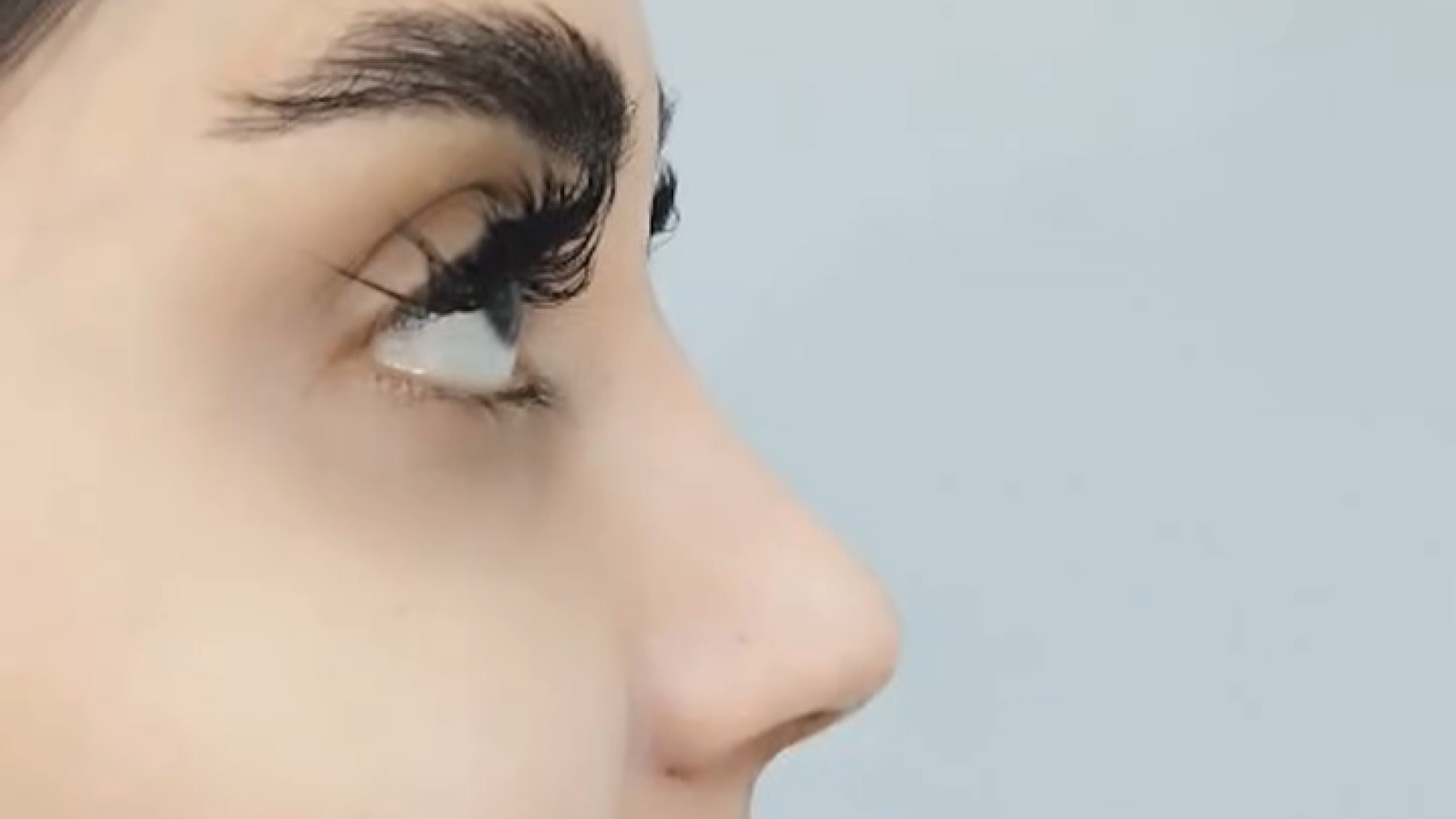 نتیجه عمل بینی بعد از یک ماه دکتر علی جمشیدی