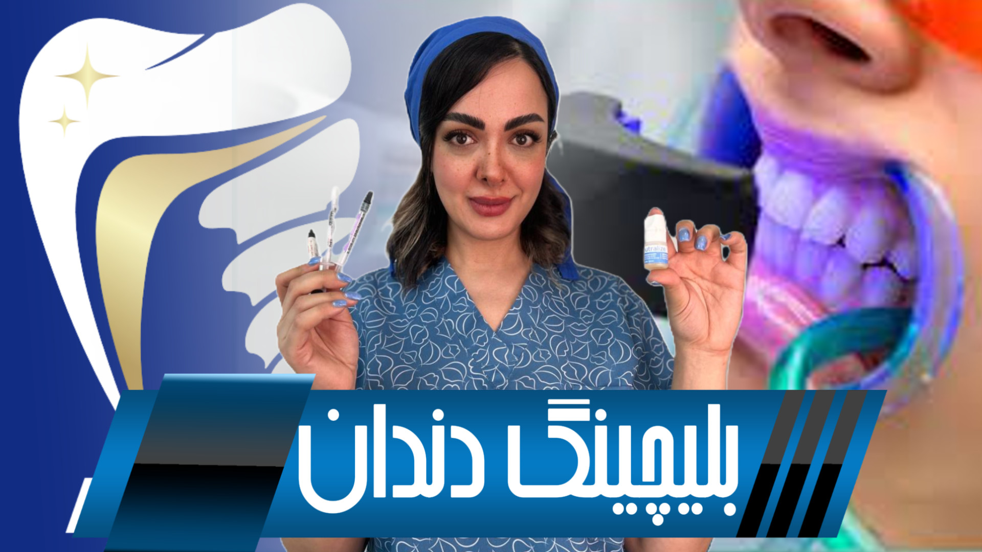 سفید کردن دندان با بلیچینگ ایم‌دولیموماب