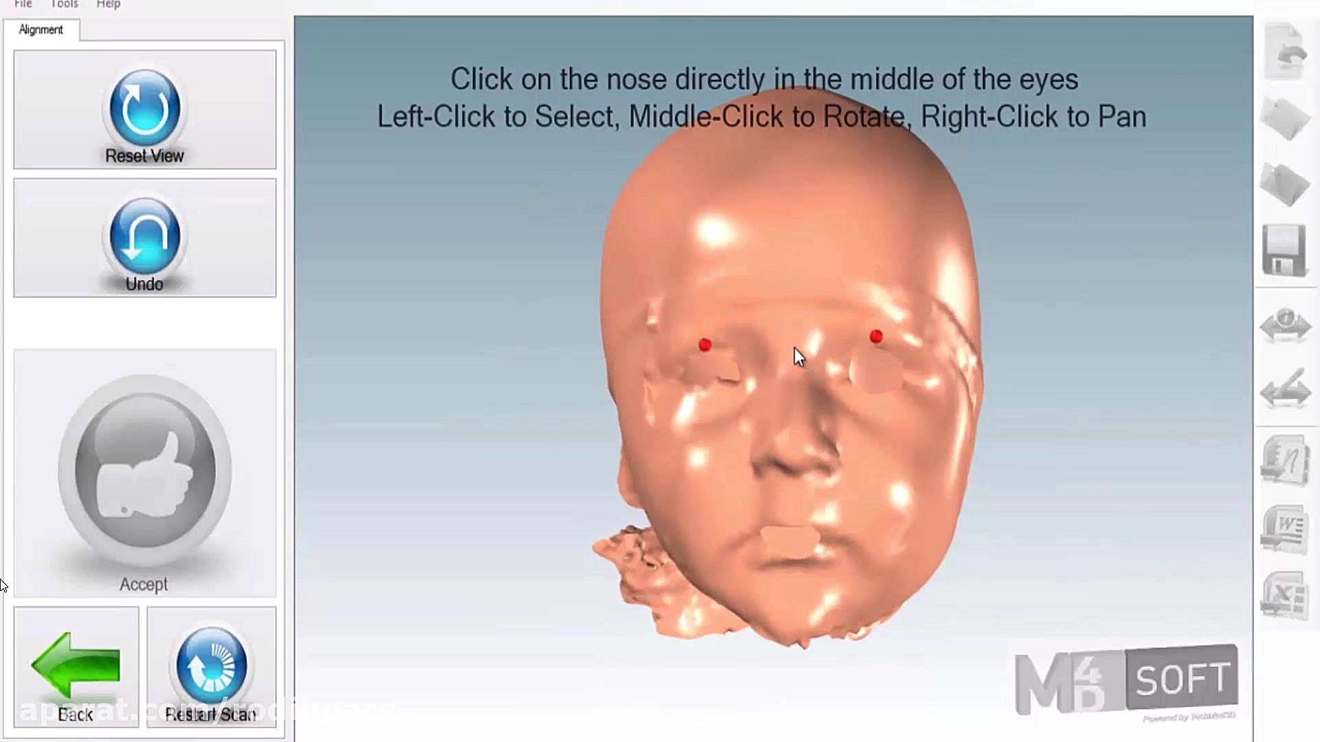 head scan توپلیزوماب