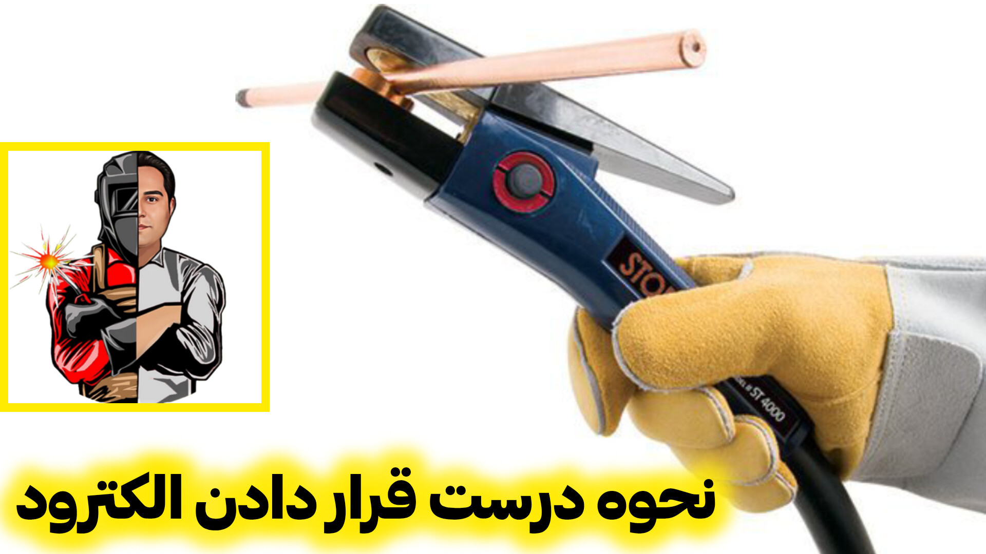نحوه درست قرار دادن الکترود بیماری آلبینیزم اوکولوتئوکوتانئوس