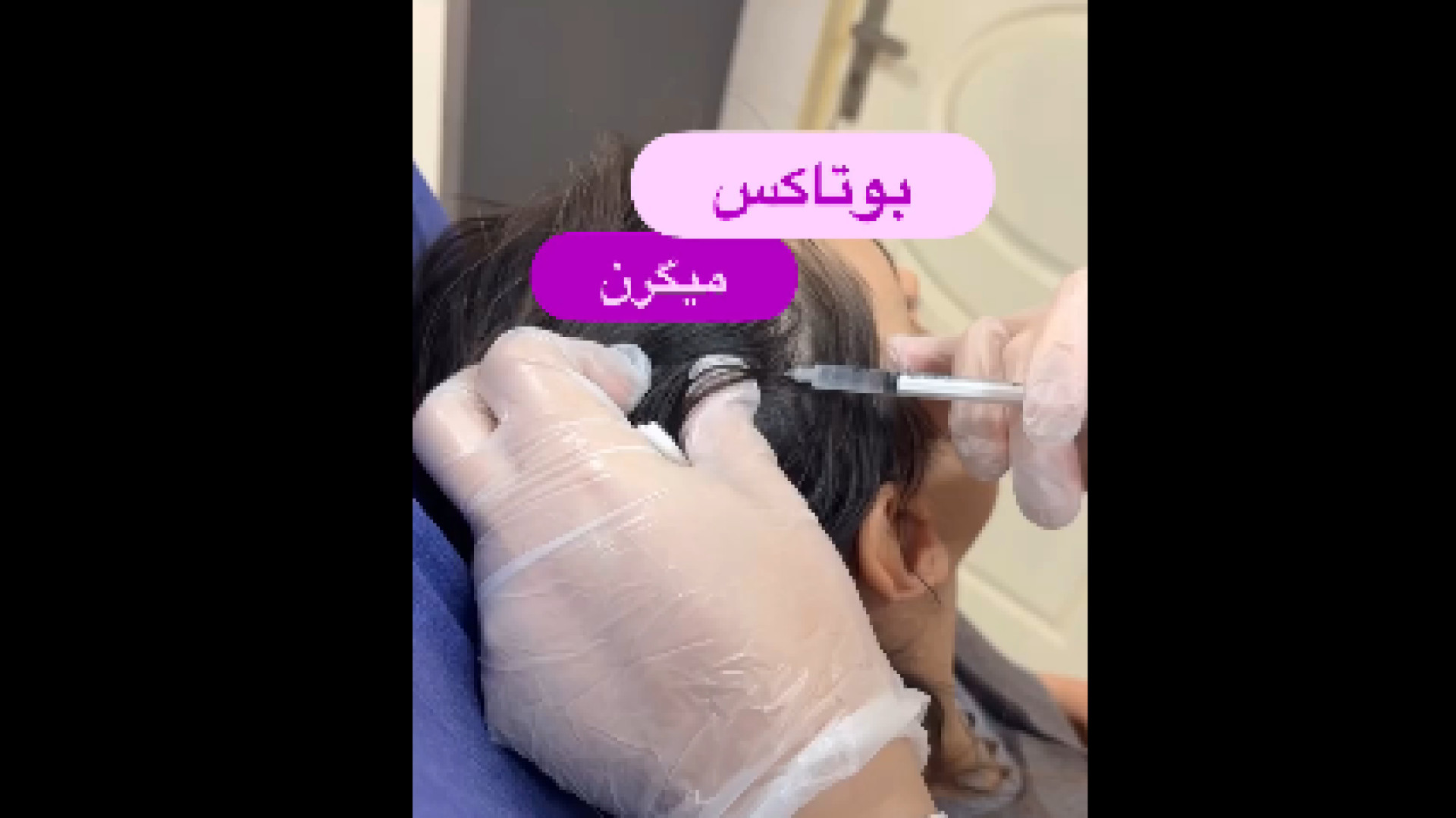 تزریق بوتاکس میگرن دکتر صدیقه نائیجی | متخصص پوست و مو در قم