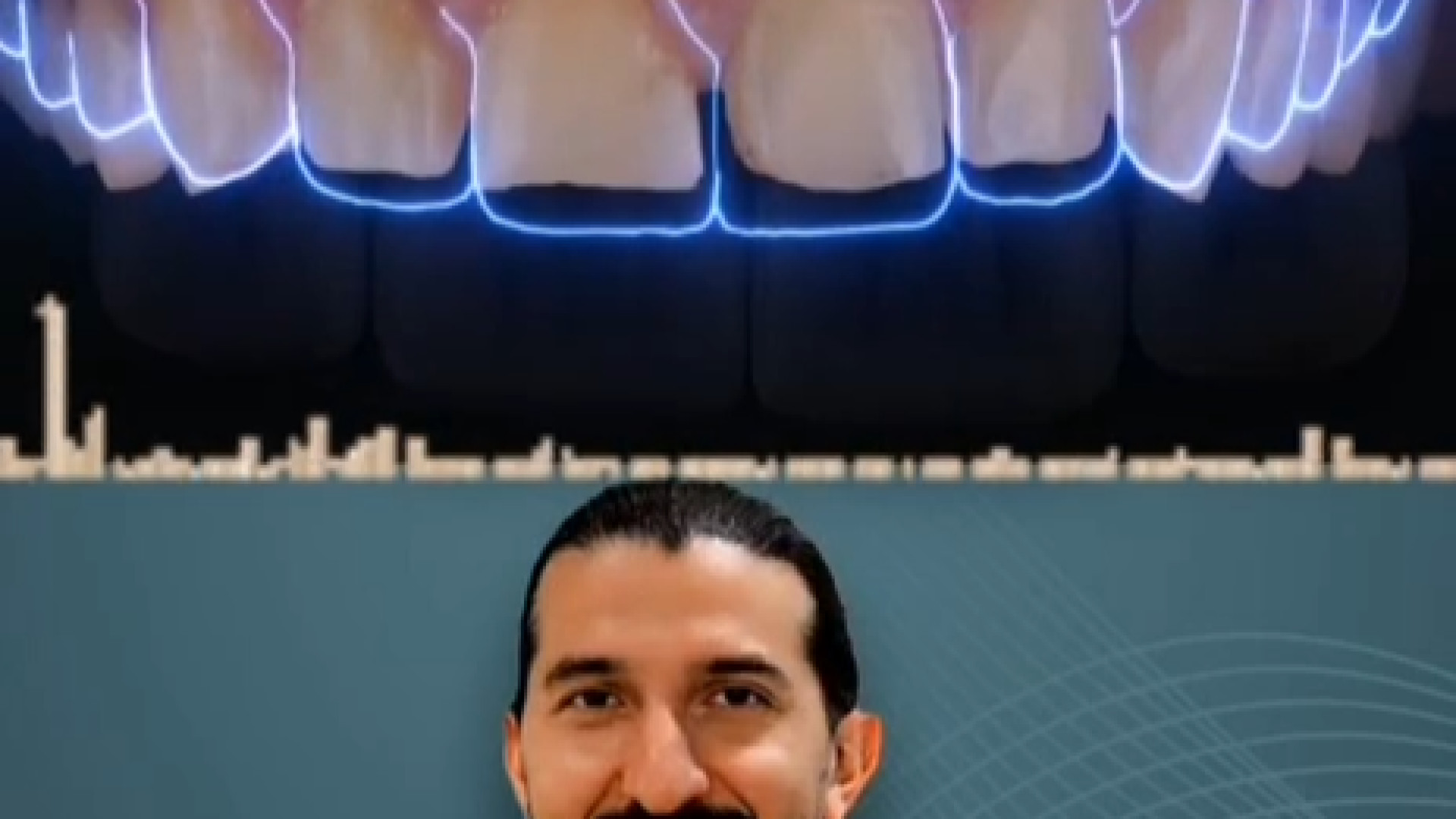 پاسخ به سوالات مراجعین عزیز دندانپزشکی دکتر امیر صلح جو دندانپزشکی دکتر امیر صلح جو