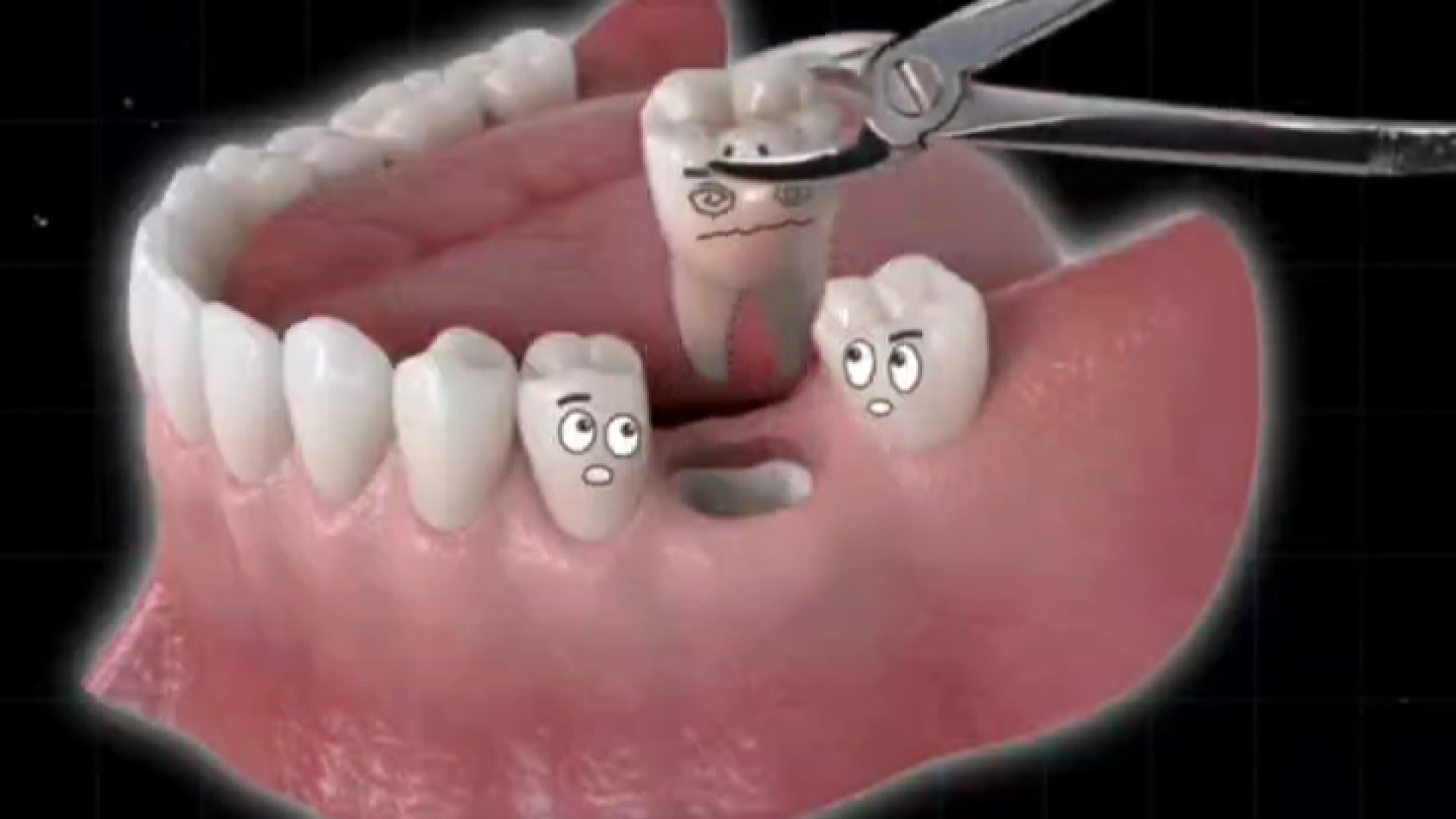 توضیحات کامل نحوه ایمپلنت دندان دندانپزشکی دکتر امیر صلح جو