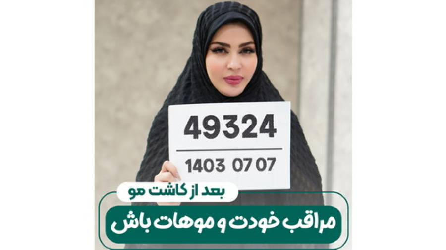 بعد از کاشت مراقب خودت و موهات باش /دادگاه کاشت مو