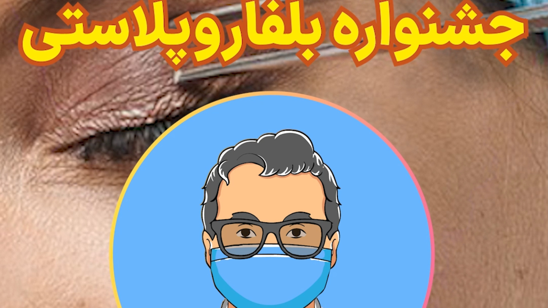 بلفاروپلاستی دکتر پیام شهابی کاردیومگالی