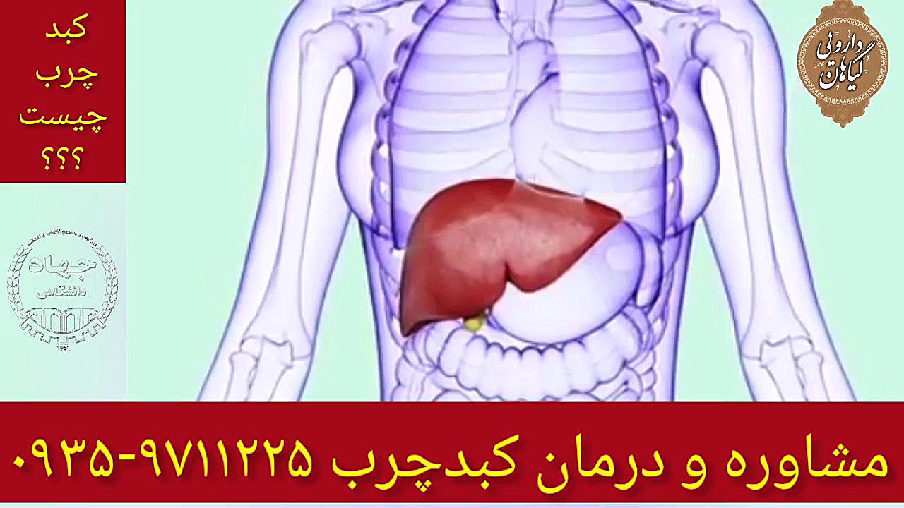 کبدچرب چیست؟ درمان و پاکسازی کبدچرب ۰۹۳۵۹۷۱۱۲۳۵ کلینیک دندانپزشکی