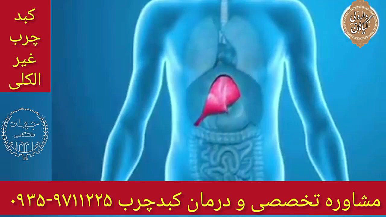 علائم کبدچرب غیرالکلی درمان و پاکسازی کبدچرب ۰۹۳۵۹۷۱۱۲۲۵ درمان سلولیت