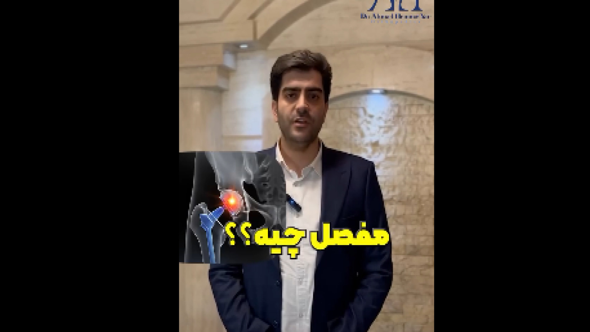 چرا تروما در آسیب مفصلی اهمیت دارد؟ دکتر احمد همت یار - جراح و متخصص ارتوپدی