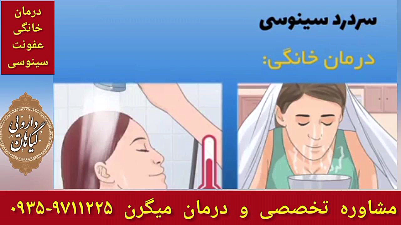 درمان سینوزیت درمان میگرن و سردرد عصبی ۰۹۳۵۹۷۱۱۲۲۵ ترمیم دندان
