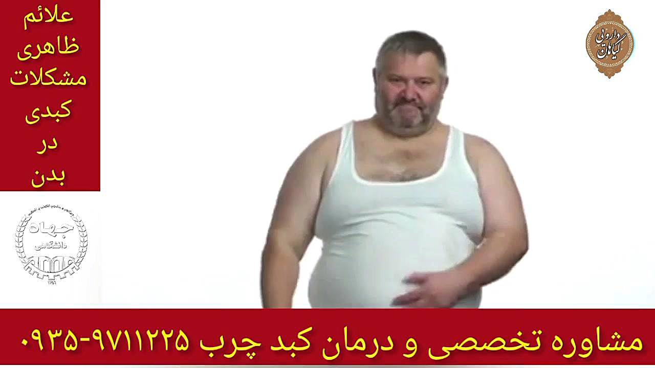 علائم ظاهری کبدچرب درمان و پاکسازی کبد چرب ۰۹۳۵۹۷۱۱۲۲۵ برداشتن زگیل