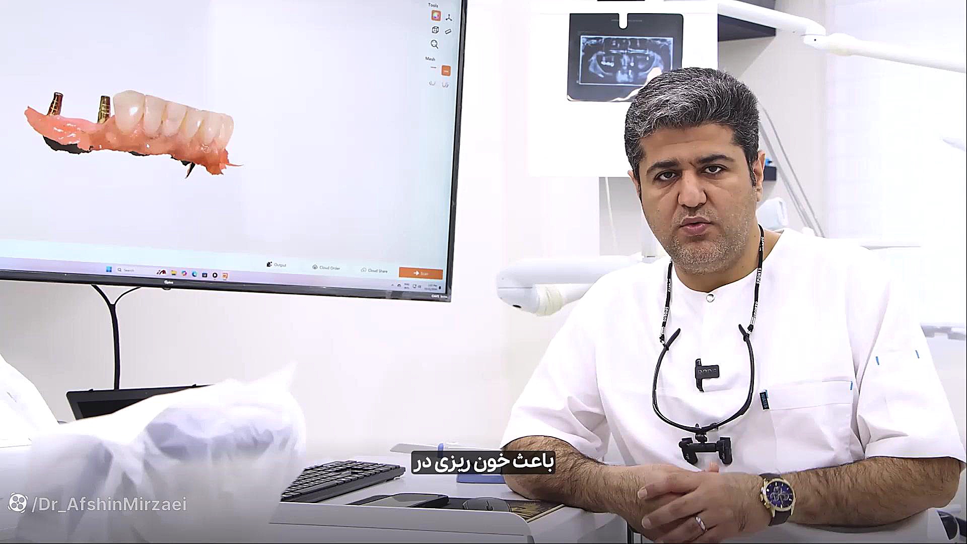 مراقبت های بعد از ایمپلنت دندان و پیوند استخوان پزشکی زیرآب