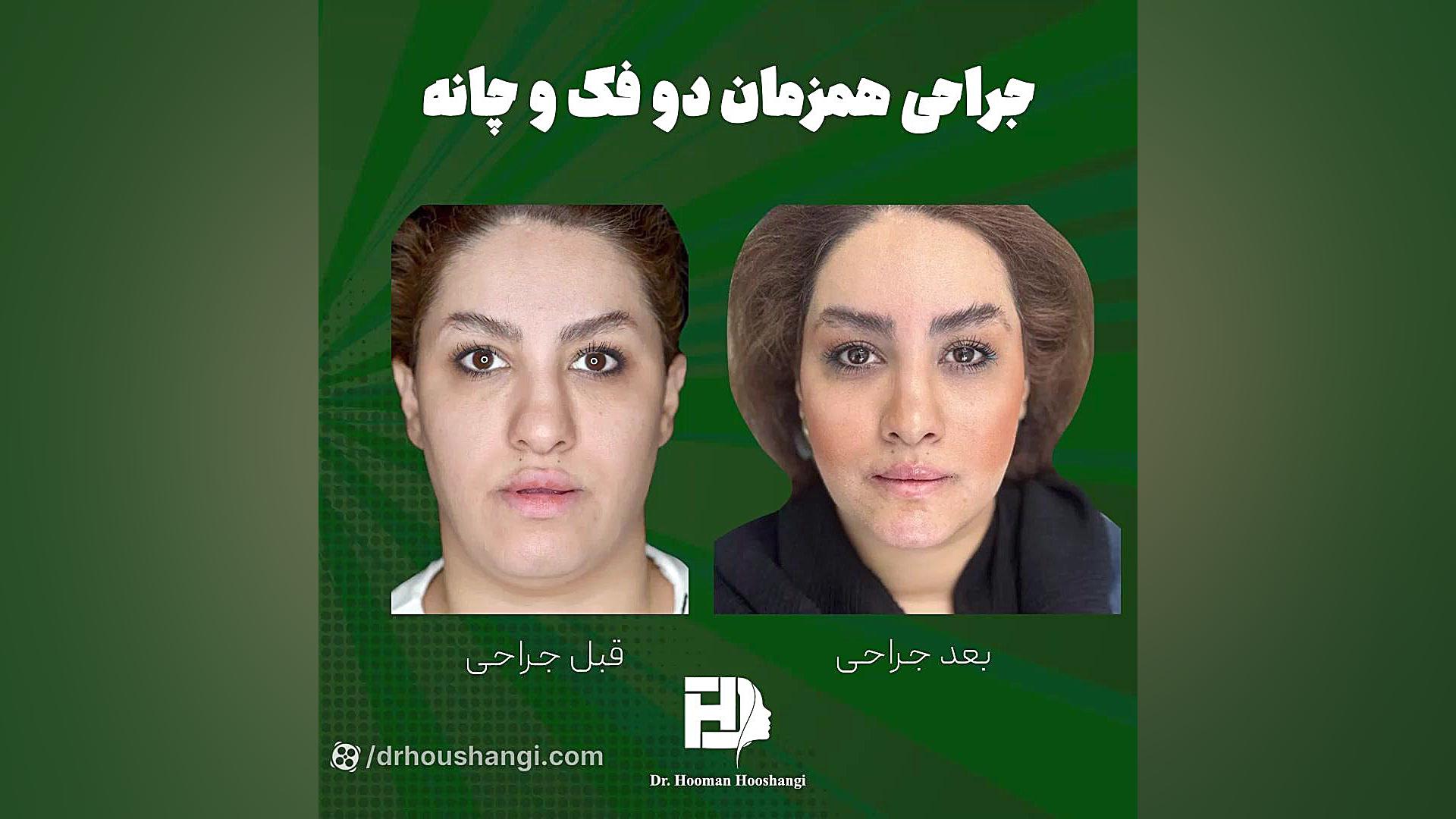 جراحی فک و صورت توسط دکتر هومن هوشنگی درمان سلول‌های بنیادی