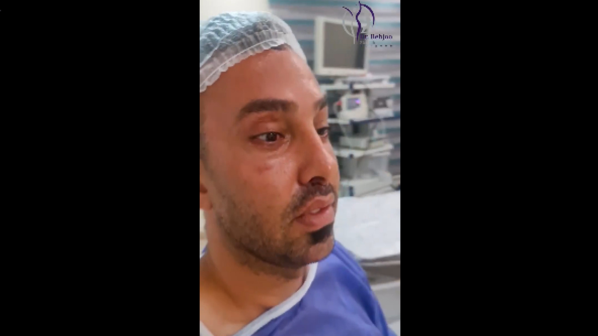 نتیجه لیفت شقیقه پلک و سانترال لب دکتر شاهین بهجو - فوق تخصص جراحی پلاستیک