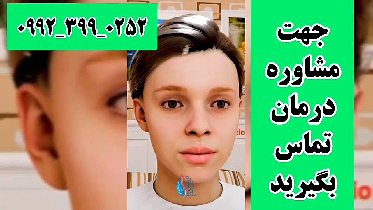 دیستونی پلک چیه؟ پرت و پلا