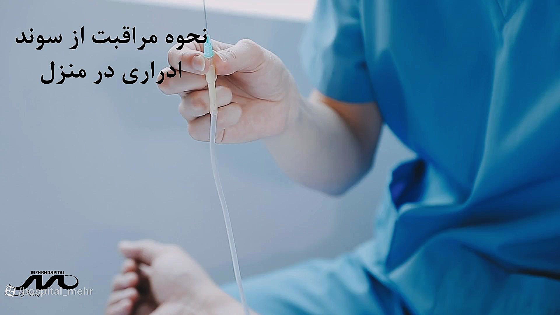 سوند ارداری ترمیم زیبایی دندان