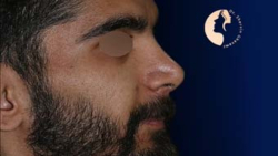truncate dir-rtl