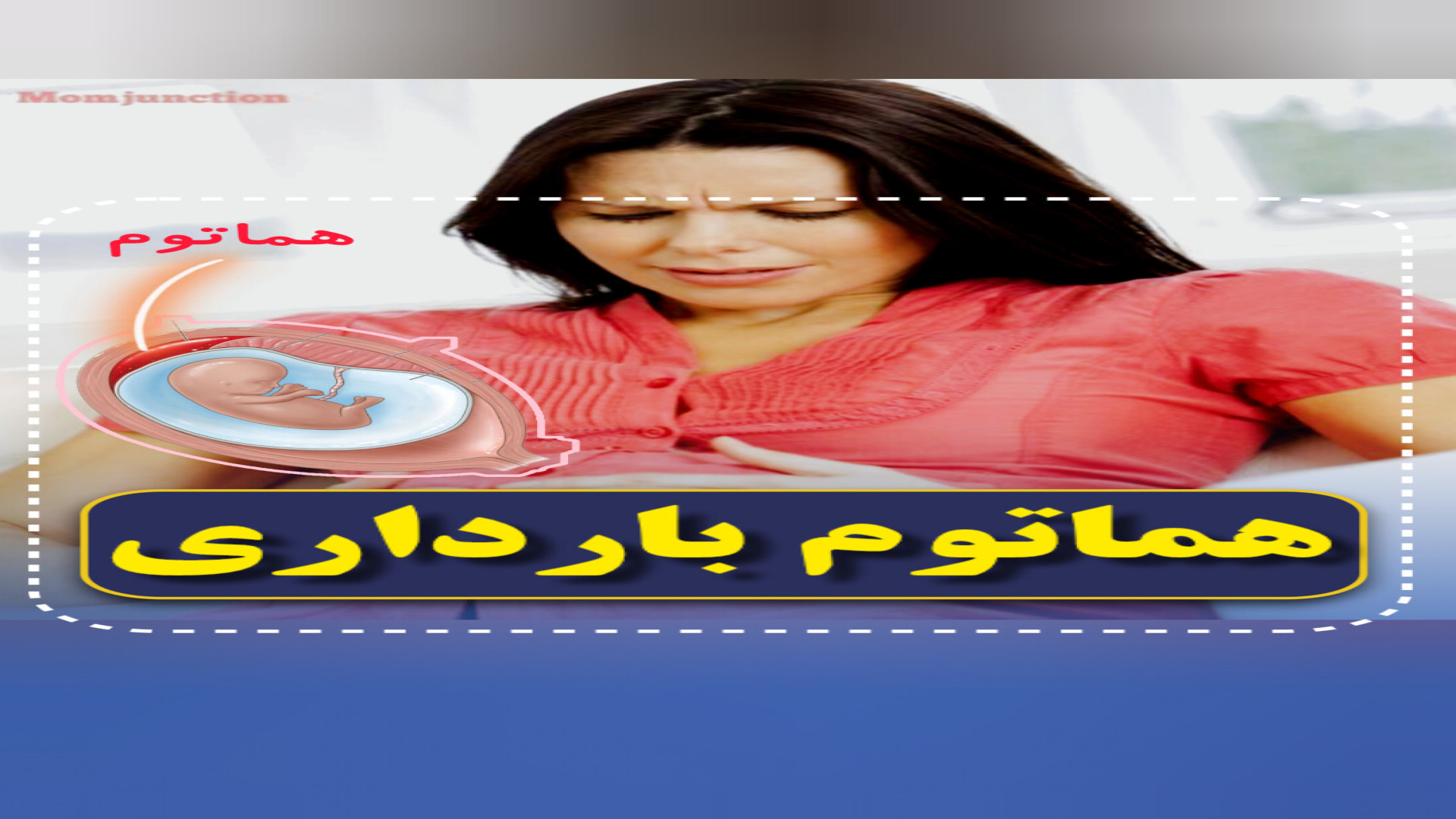 هماتوم بارداری چیه؟!۰۲۱۲۲۹۱۱۳۷۰ مرکز تصویربرداری دکتر مریم ابراهیمی، مبنا-تهران